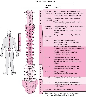 diseases of the body associated with damage to various parts of the spine