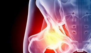 causes of development of hip arthrosis