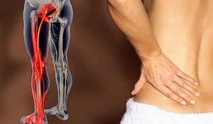 Features of low back pain