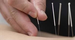 methods of treating back pain