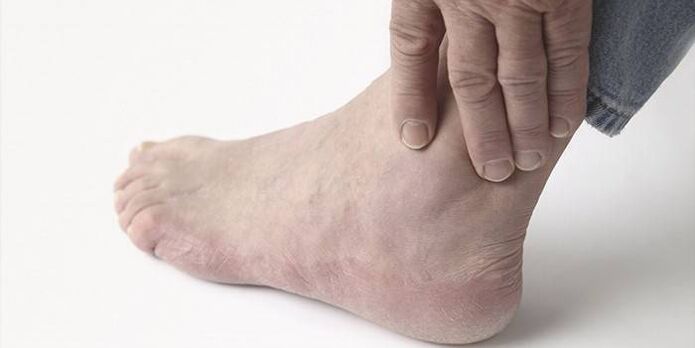 pain in ankle osteoarthritis