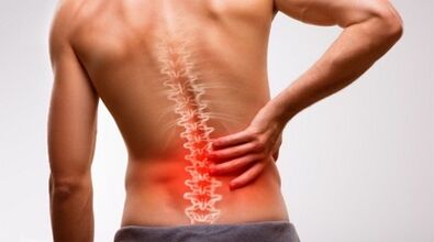 Signs and symptoms of osteocondrosis of the lomber spine